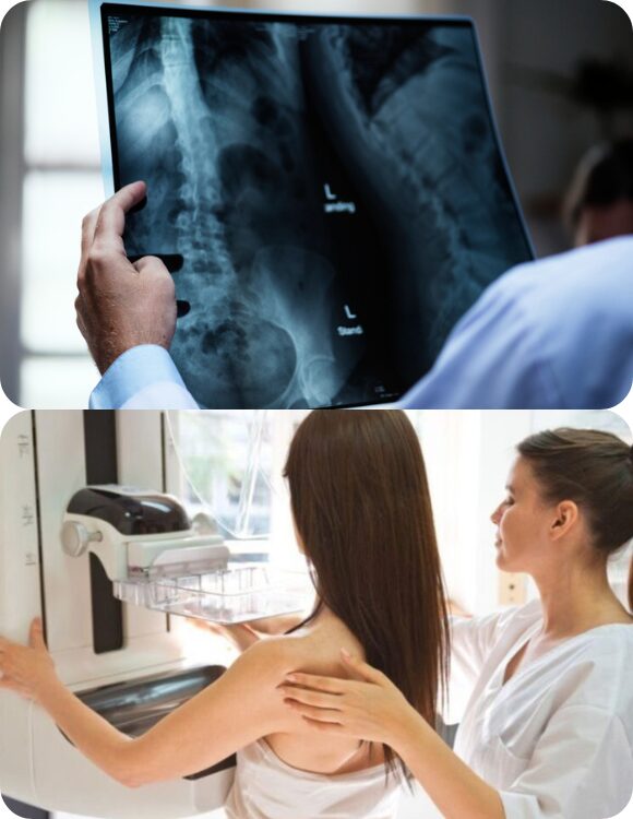 X-Ray And Digital Mammography In Dubai