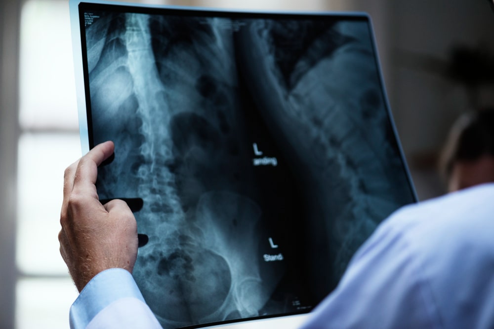 Upright MRI in Dubai