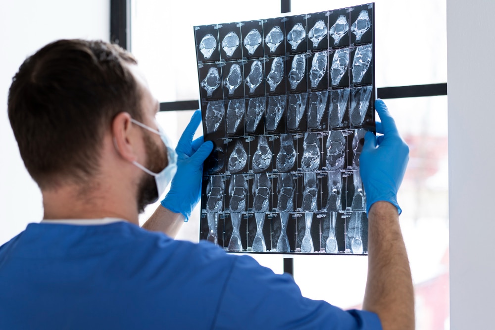 Full Body MRI Scan in Dubai