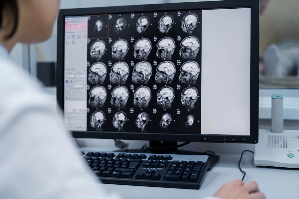 Upright MRI in Dubai