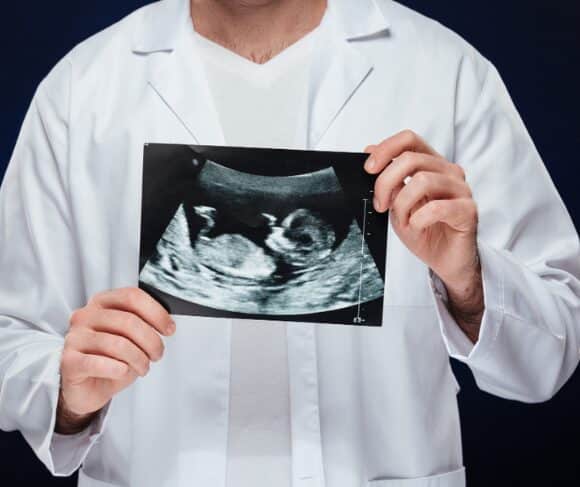 Ultrasound/Doppler Study