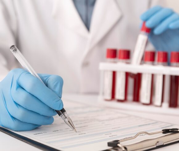 Blood Sample Collection at Home