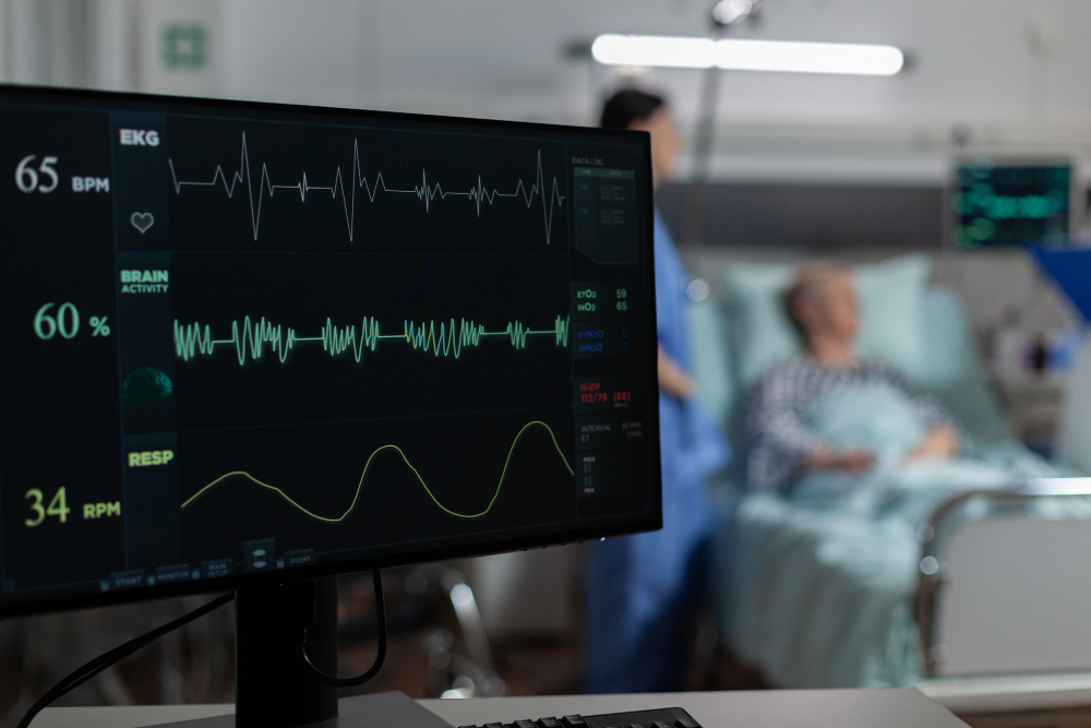 Ideal Heart Rate for the Scan