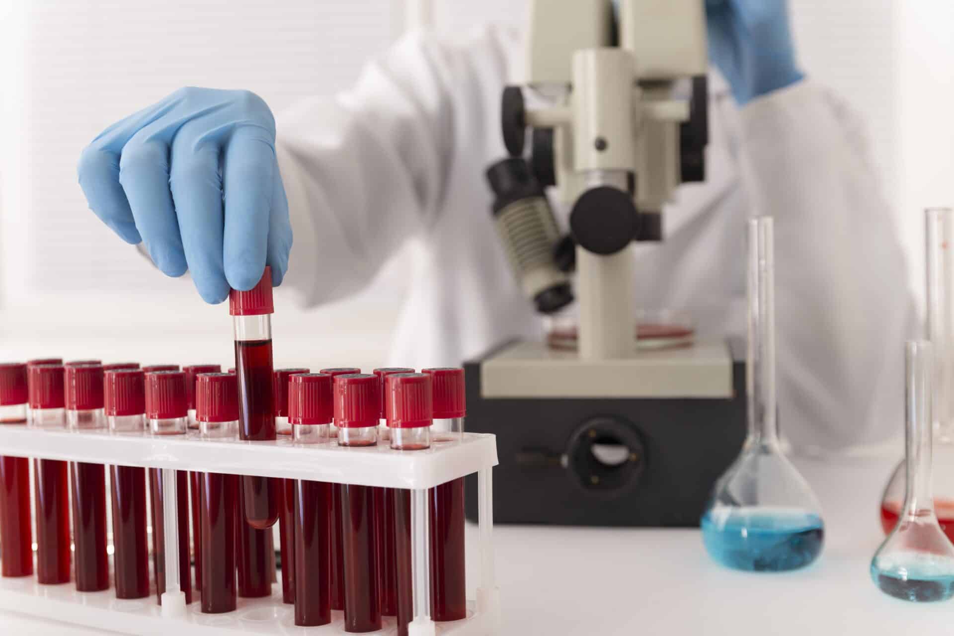 carrier screening test