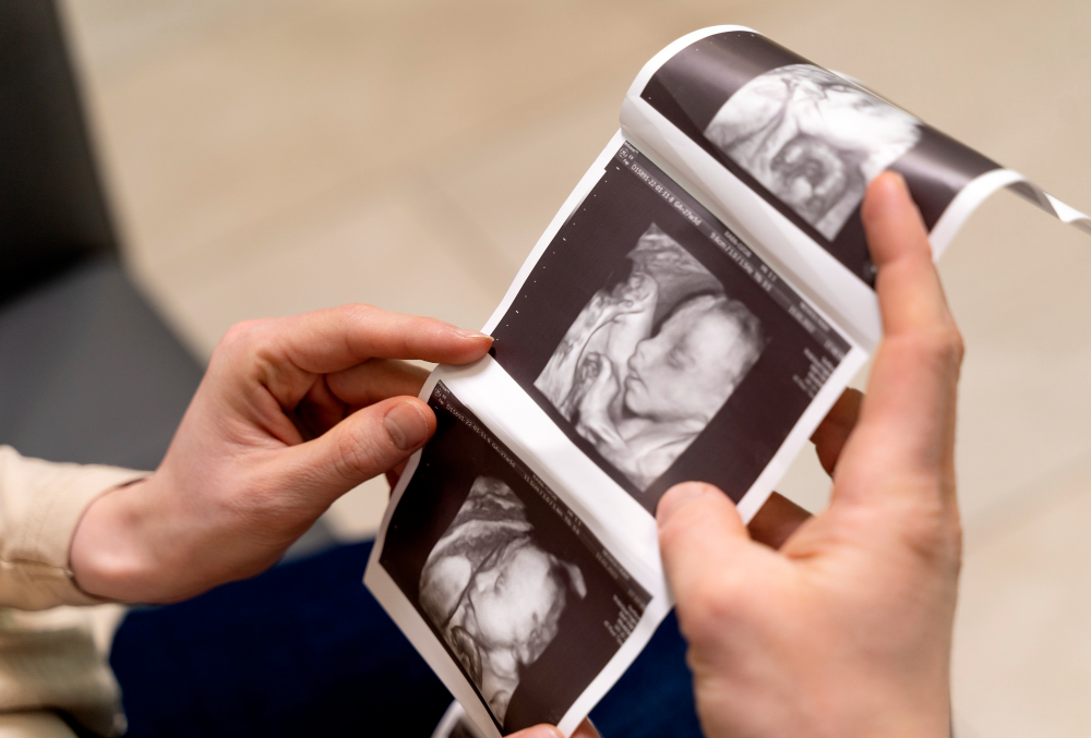 ]When Should You Get an NT Scan?