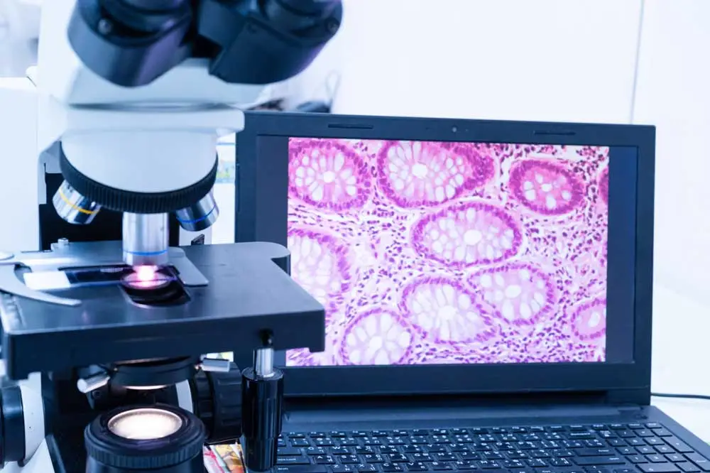 Immunohistochemistry