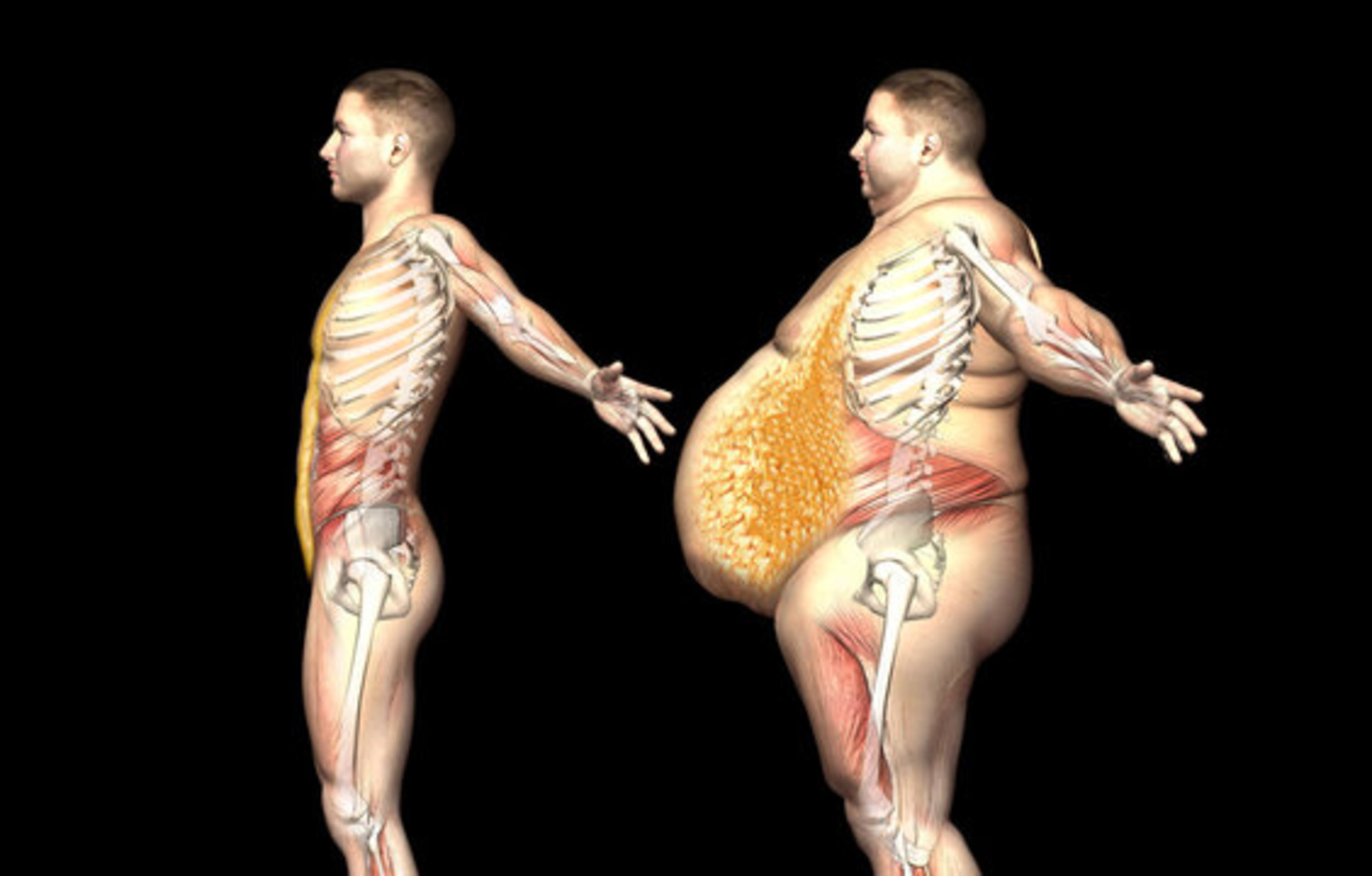 Visceral Fat vs Subcutaneous Fat: How a DEXA Scan Helps You Measure and Manage Both