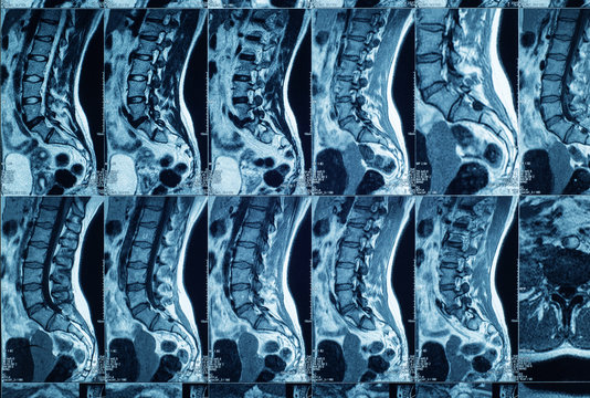 spine MRI Dubai