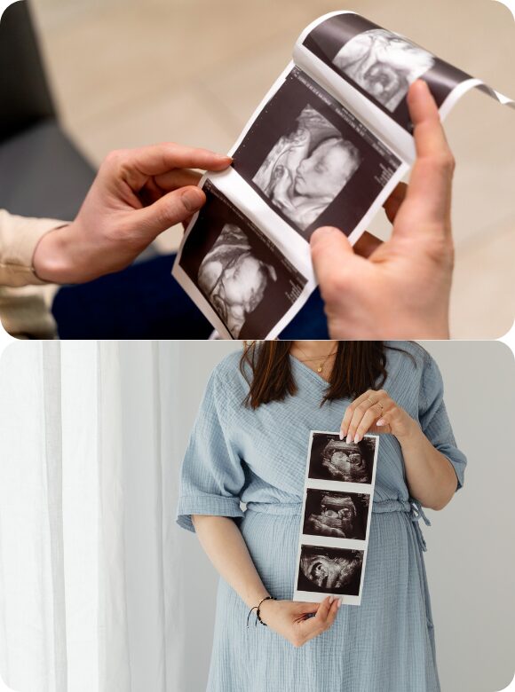 Ultrasound Scanning