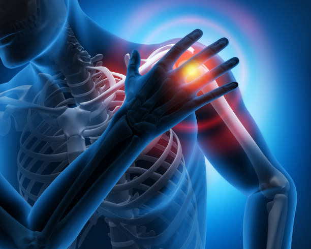 Shoulder MRI