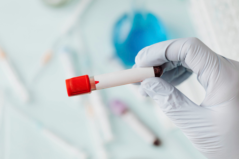 What Is the Folate Receptor Antibody Test (FRAT)?