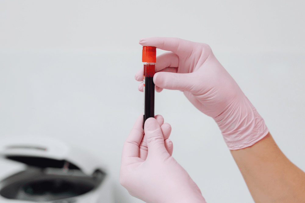 PCR-Based Detection